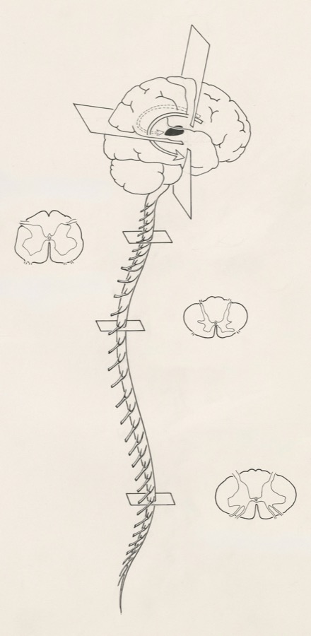 Historical brain and spinal cord illustration